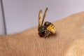 Hornet bites a manÃ¢â¬â¢s hand on a white background